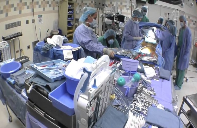 What You Need to Know about heart transplant Surgery